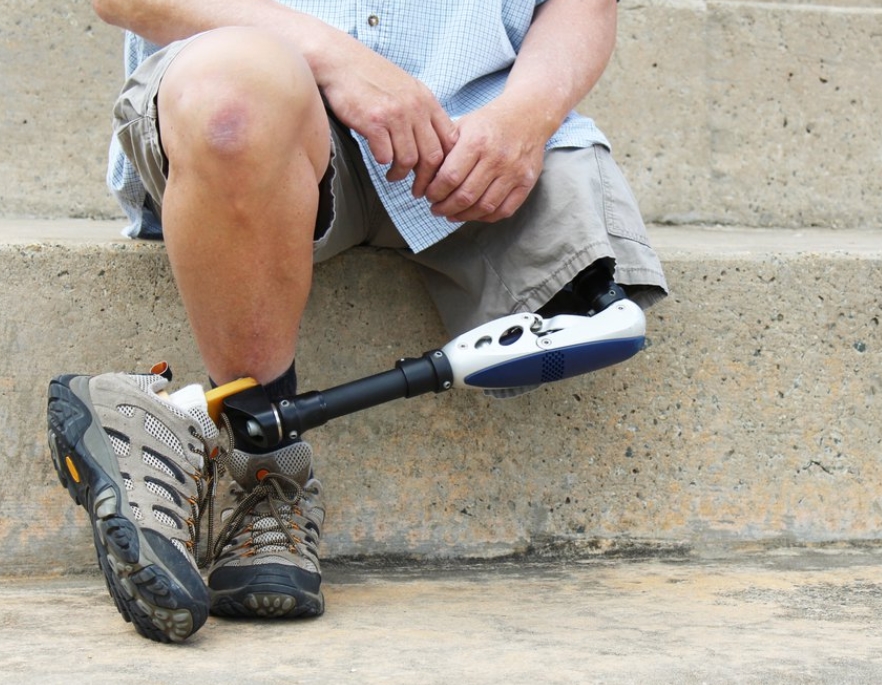 Removing Stuck Prostheses